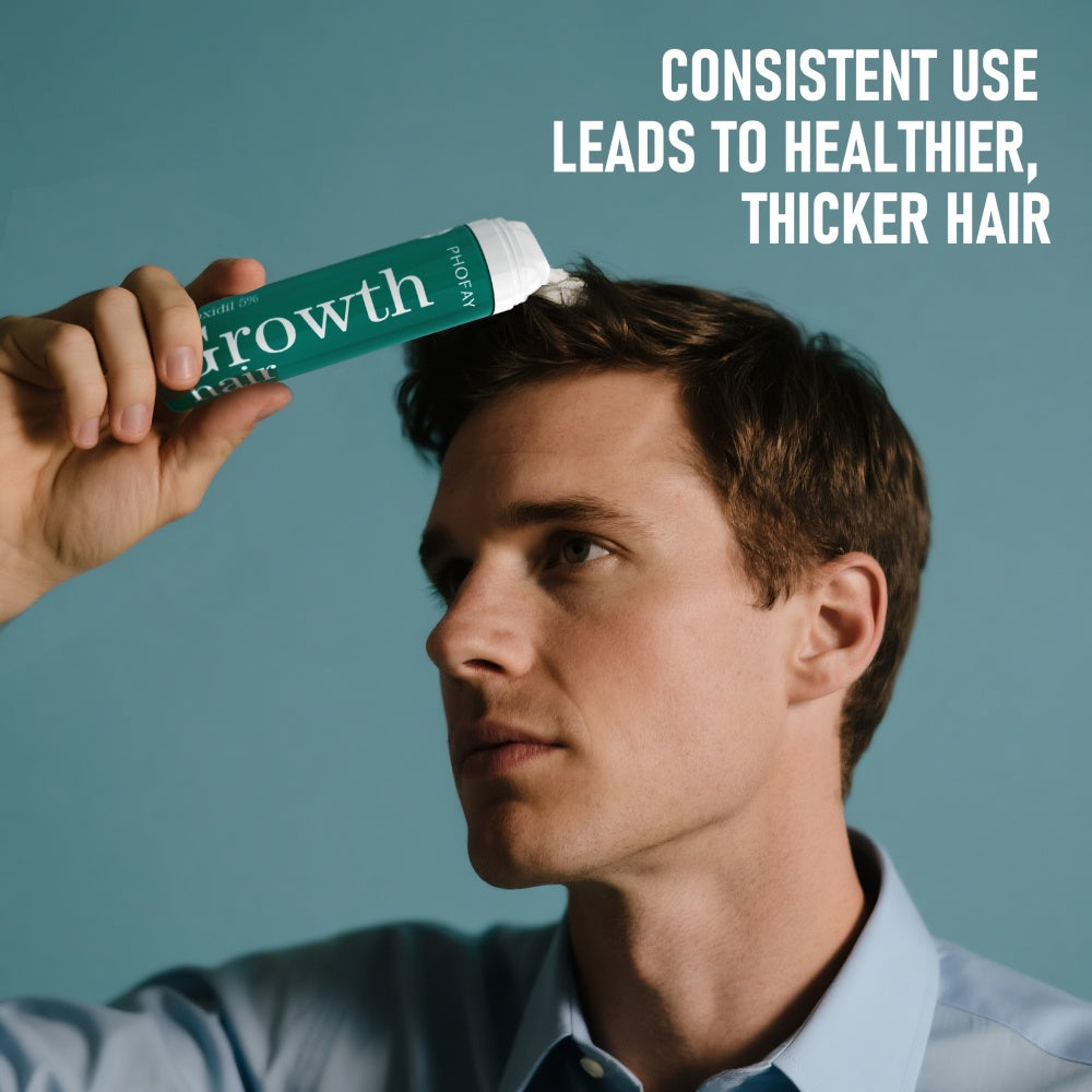 Velorian Collection CH004 Minoxidil Anti-Hair Loss Mousse in a white foam container, designed for hair growth support.
