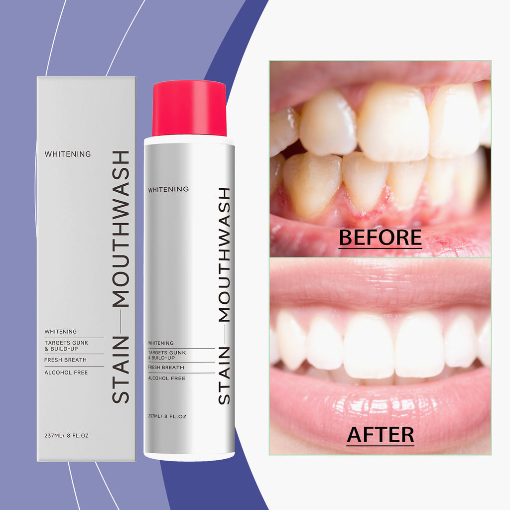 Velorian Collection stain-removing whitening mouthwash in a 237ml bottle, designed for oral health and fresh breath.