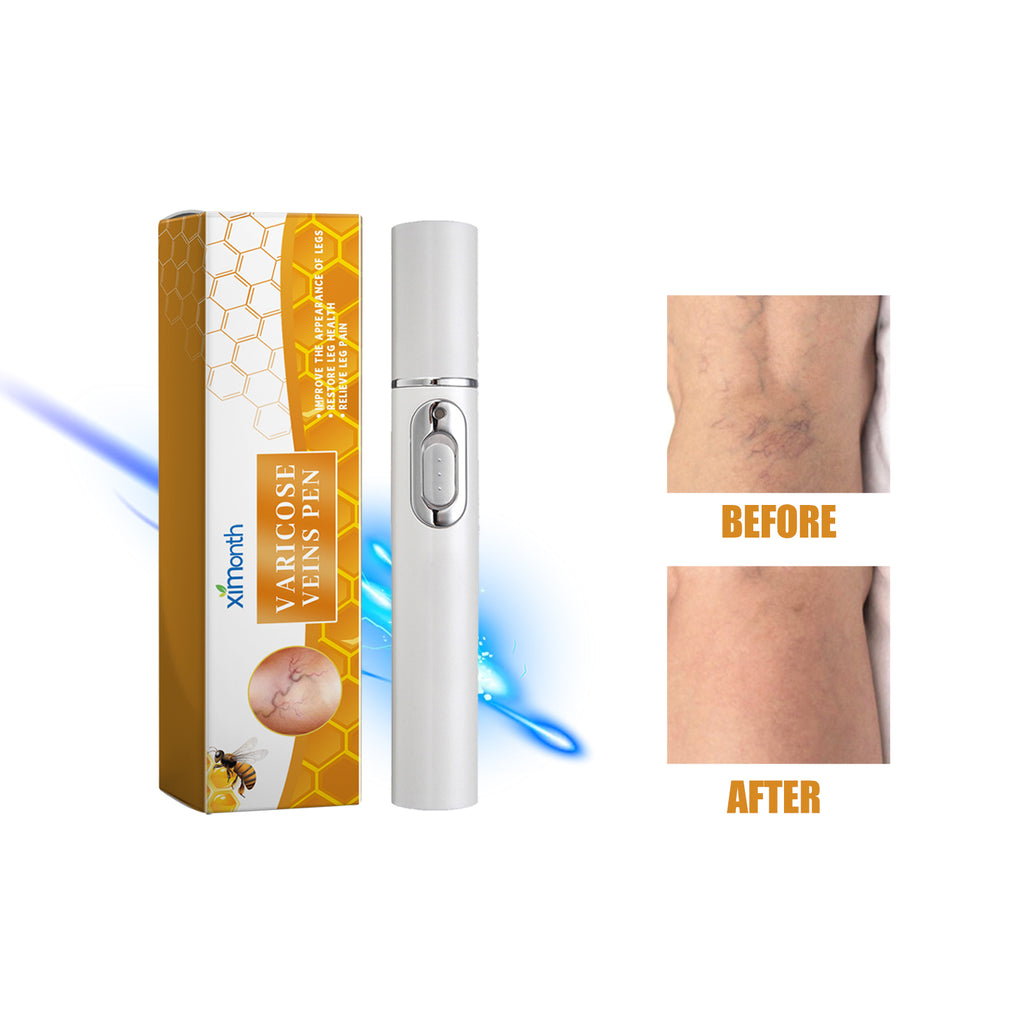 Velorian Collection Leg Soothing Laser Pen used for health care, handheld device for pain relief and muscle relaxation.