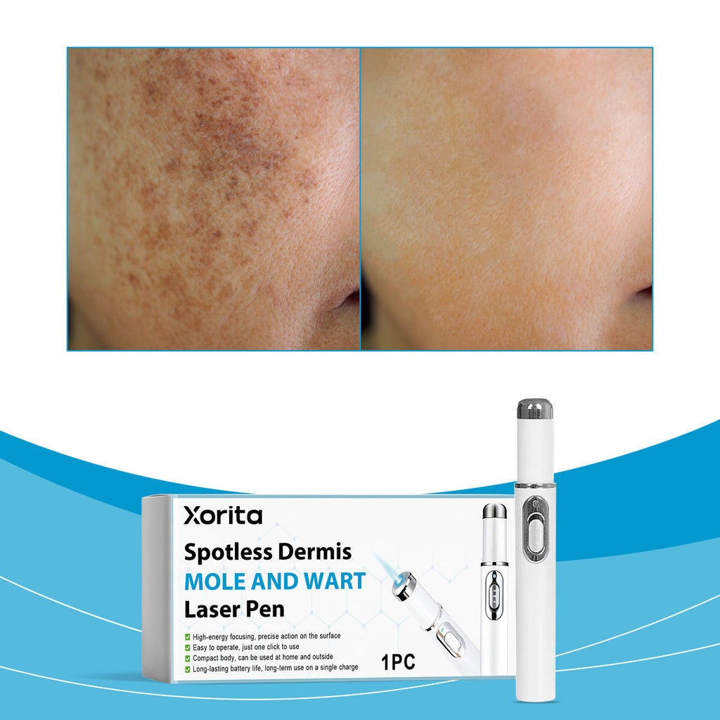 Velorian Collection skin care laser pen showing sleek handheld device with control buttons on a white background.