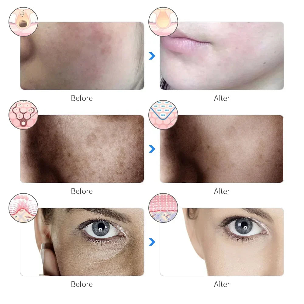 NNEOBA 7-Color LED Photon Therapy Rechargeable Facial Mask - Skin Rejuvenation & Beauty Device