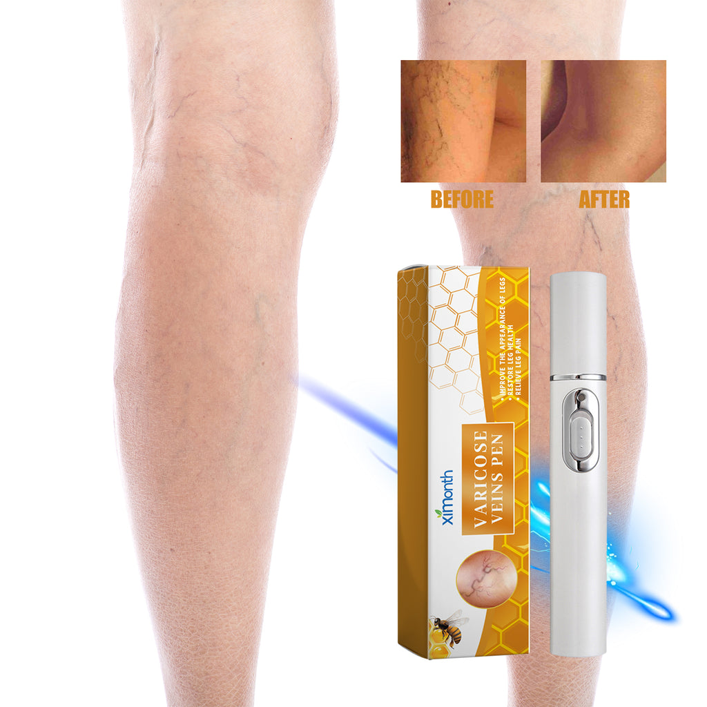 Velorian Collection Leg Soothing Laser Pen for health care, handheld device with sleek design for pain relief and muscle relaxation.